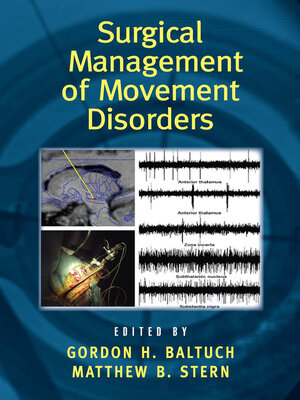 cover image of Surgical Management of Movement Disorders